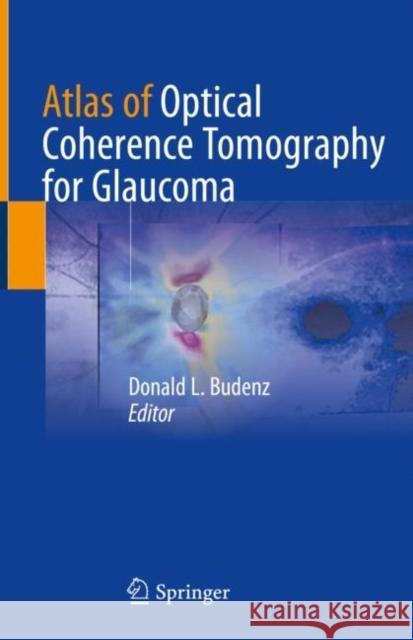 Atlas of Optical Coherence Tomography for Glaucoma Donald L. Budenz 9783030467913 Springer - książka