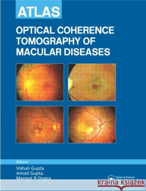 Atlas of Optical Coherence Tomography of Macular Diseases Vishali Gupta Amod Gupta Mangat R. Dogra 9781841844688 Taylor & Francis Group - książka