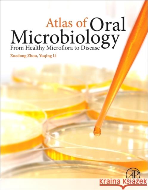 Atlas of Oral Microbiology : From Healthy Microflora to Disease Zhou, Xuedong Li, Yuqing  9780128022344 Elsevier Science - książka