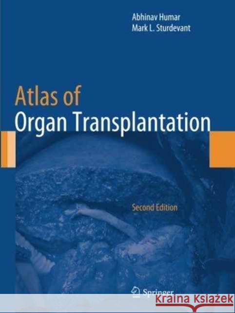 Atlas of Organ Transplantation Abhinav Humar Mark L. Sturdevant 9781447168270 Springer - książka