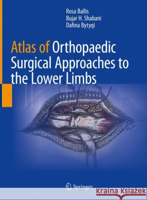 Atlas of Orthopaedic Surgical Approaches to the Lower Limbs Rosa Ballis Bujar H. Shabani Dafina Bytyqi 9783031077227 Springer International Publishing AG - książka