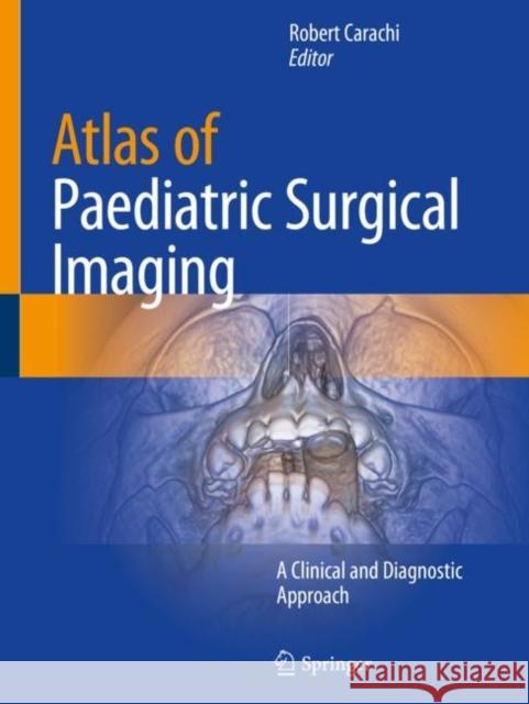 Atlas of Paediatric Surgical Imaging: A Clinical and Diagnostic Approach Robert Carachi 9783030323868 Springer - książka