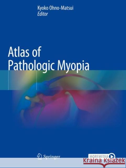 Atlas of Pathologic Myopia  9789811542633 Springer Singapore - książka