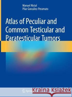 Atlas of Peculiar and Common Testicular and Paratesticular Tumors Manuel Nistal Pilar Gonzalez-Peramato 9783030196530 Springer - książka
