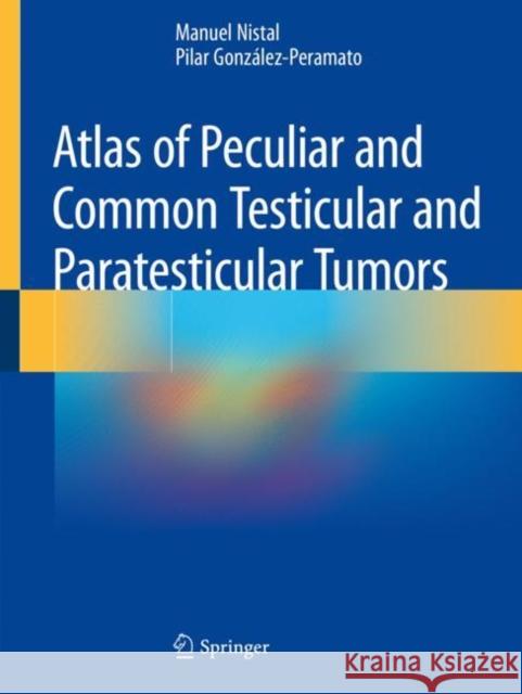 Atlas of Peculiar and Common Testicular and Paratesticular Tumors Nistal, Manuel, González-Peramato, Pilar 9783030196561 Springer International Publishing - książka