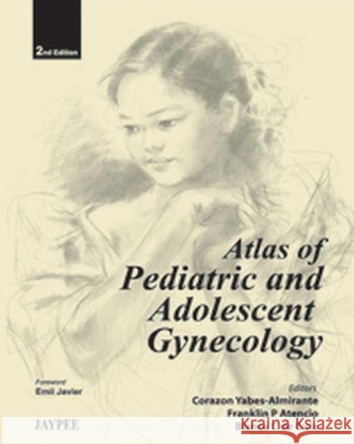 Atlas of Pediatric and Adolescent Gynecology  9789350256411 Jaypee Brothers Medical Publishers - książka