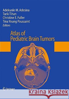 Atlas of Pediatric Brain Tumors  9781441910615 SPRINGER-VERLAG NEW YORK INC. - książka