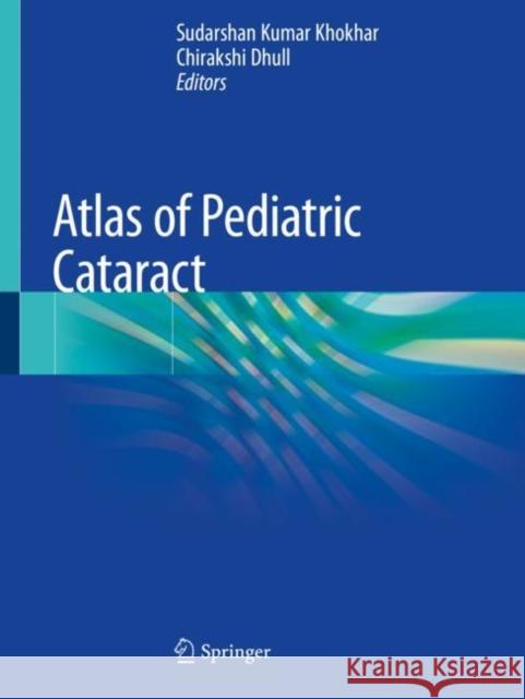 Atlas of Pediatric Cataract Sudarshan Kumar Khokhar Chirakshi Dhull 9789811369414 Springer - książka