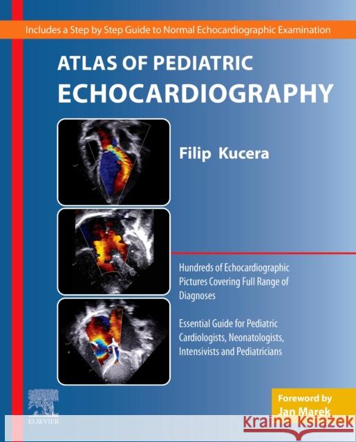 Atlas of Pediatric Echocardiography Filip Kucera 9780323759816 Elsevier - Health Sciences Division - książka