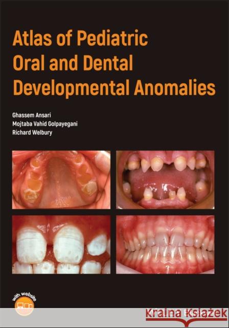 Atlas of Pediatric Oral and Dental Developmental Anomalies Ghassem Ansari Mojtaba Vahid Golpayegani Richard Welbury 9781119380856 Wiley-Blackwell - książka