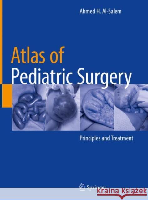 Atlas of Pediatric Surgery: Principles and Treatment Al-Salem, Ahmed H. 9783030292102 Springer - książka