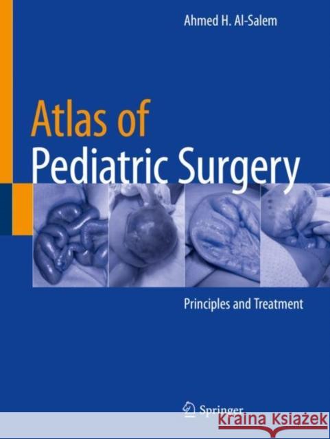 Atlas of Pediatric Surgery: Principles and Treatment Ahmed H. Al-Salem 9783030292133 Springer - książka