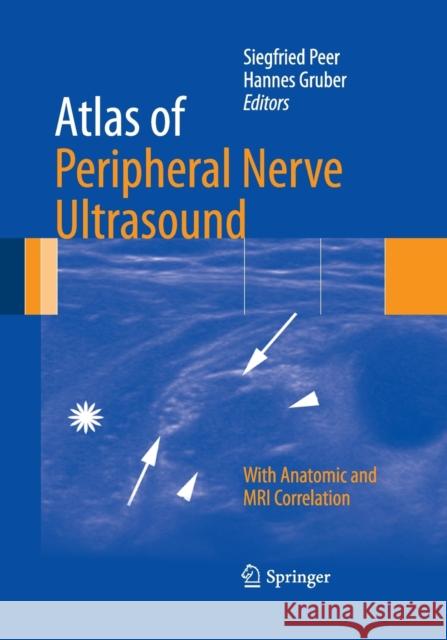 Atlas of Peripheral Nerve Ultrasound: With Anatomic and MRI Correlation Peer, Siegfried 9783662520550 Springer - książka