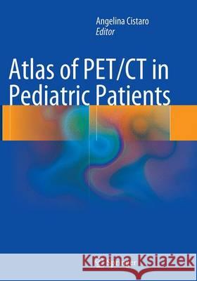 Atlas of Pet/CT in Pediatric Patients Cistaro, Angelina 9788847058729 Springer - książka