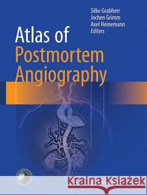 Atlas of Postmortem Angiography Silke Grabherr Jochen Grimm Axel Heinemann 9783319285351 Springer - książka