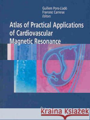 Atlas of Practical Applications of Cardiovascular Magnetic Resonance Pons-Liado Guillem Guillem Pons-Llado Francesc0 Carreras 9780387236322 Springer Science+Business Media - książka