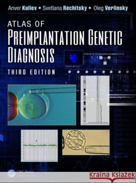 Atlas of Preimplantation Genetic Diagnosis Anver Kuliev Svetlana Rechitsky Oleg Verlinsky 9781466598393 CRC Press - książka