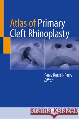 Atlas of Primary Cleft Rhinoplasty Percy Rossell-Perry 9783031680113 Springer - książka