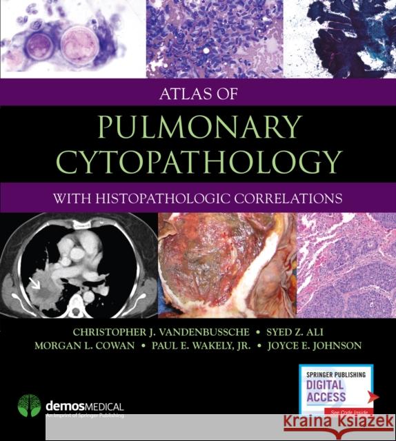 Atlas of Pulmonary Cytopathology Ali 9781936287161 Demos Medical Publishing - książka