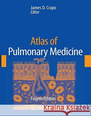 Atlas of Pulmonary Medicine James D. Crapo W. Langenfeld M. Looney 9781573402934 CMG - książka