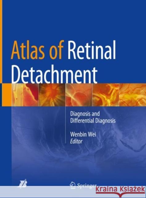 Atlas of Retinal Detachment: Diagnosis and Differential Diagnosis Wei, Wenbin 9789811082306 Springer - książka