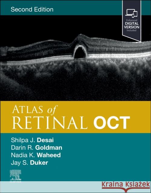 Atlas of Retinal OCT: Optical Coherence Tomography  9780323930437 Elsevier - Health Sciences Division - książka