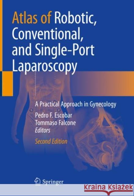 Atlas of Robotic, Conventional, and Single-Port Laparoscopy: A Practical Approach in Gynecology Escobar, Pedro F. 9783030932121 Springer International Publishing - książka