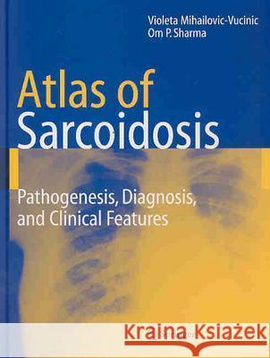 Atlas of Sarcoidosis: Pathogenesis, Diagnosis and Clinical Features Violeta Mihailovic-Vucinic Om P. Sharma 9781852338091 Springer - książka