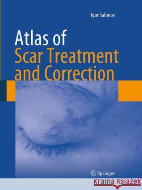 Atlas of Scar Treatment and Correction Igor Safonov 9783662521656 Springer - książka