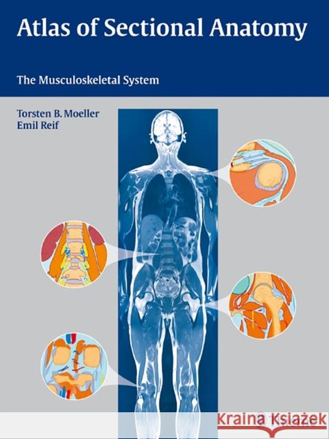 Atlas of Sectional Anatomy: The Musculoskeletal System Möller, Torsten Bert 9783131465412 Thieme Medical Publishers - książka