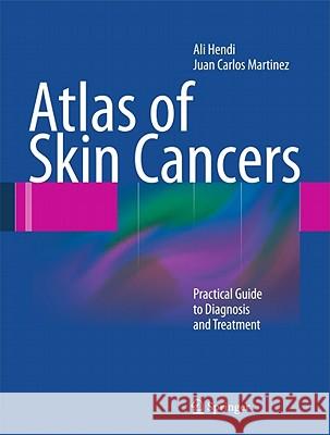 Atlas of Skin Cancers: Practical Guide to Diagnosis and Treatment Hendi, Ali 9783642133985  - książka