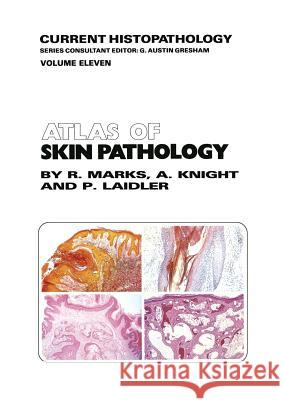 Atlas of Skin Pathology R. M. Marks A. G. Knight P. Laidler 9789401083300 Springer - książka