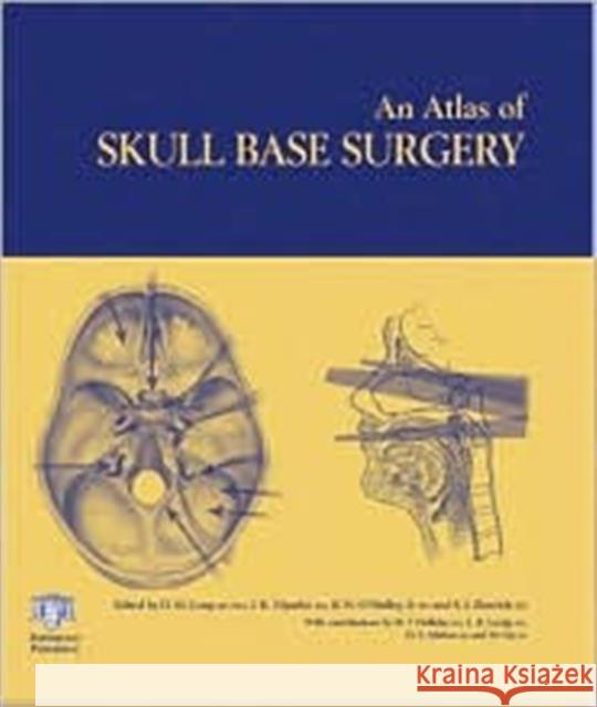 Atlas of Skull Base Surgery Donlin M. Long John K. Niparko Bert W. O'Malley 9781842141670 Taylor & Francis Group - książka