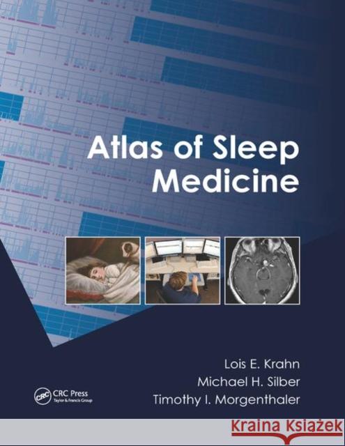 Atlas of Sleep Medicine Lois E. Krahn Michael H. Silber Timothy I. Morgenthaler 9780367383404 CRC Press - książka