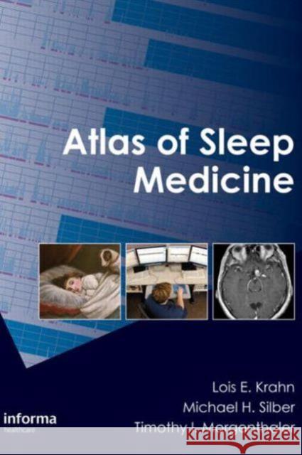 Atlas of Sleep Medicine Lois E. Krahn Michael H. Silber Timothy I. Morgenthaler 9780415450089 Informa Healthcare - książka