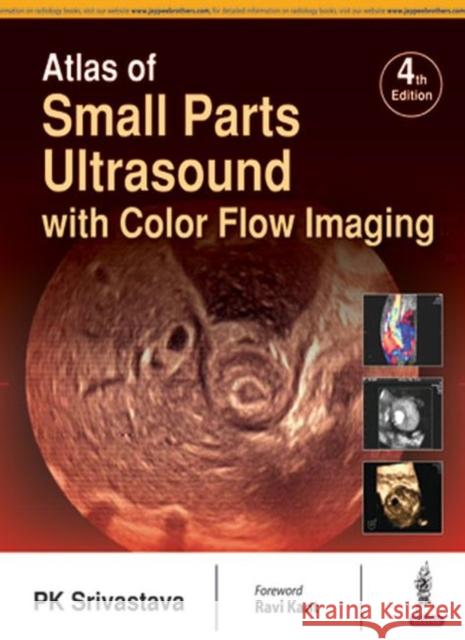 Atlas of Small Parts Ultrasound: With Color Flow Imaging Pk Srivastava 9789386261991 Jaypee Brothers, Medical Publishers Pvt. Ltd. - książka