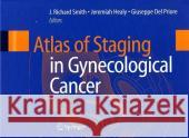 Atlas of Staging in Gynecological Cancer Smith                                    J. Richard Smith Guiseppe De 9781846284335 Springer - książka