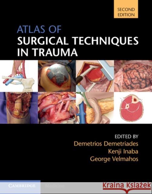 Atlas of Surgical Techniques in Trauma Demetrios Demetriades Kenji Inaba George Velmahos 9781108477048 Cambridge University Press - książka