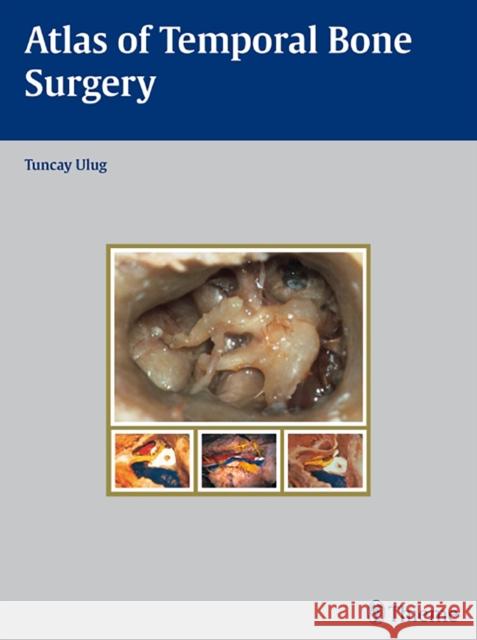 Atlas of Temporal Bone Surgery Tuncay Ulug 9783131471512 Thieme Medical Publishers - książka