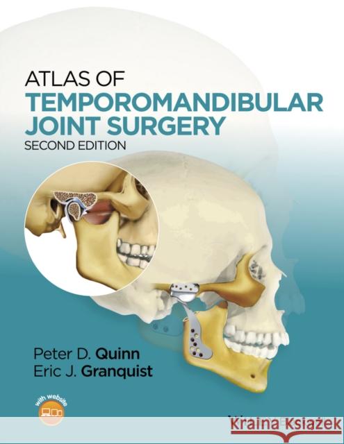 Atlas of Temporomandibular Joint Surgery Peter Quinn 9781119949855 Wiley-Blackwell - książka