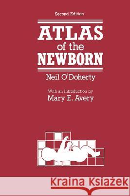 Atlas of the Newborn N. O'Doherty 9789401173322 Springer - książka