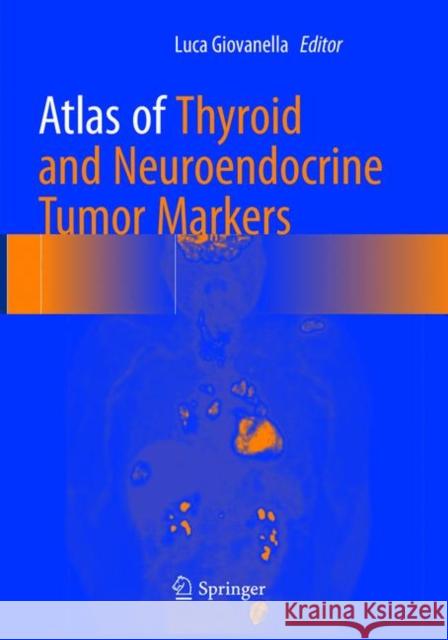 Atlas of Thyroid and Neuroendocrine Tumor Markers Luca Giovanella 9783319873305 Springer - książka
