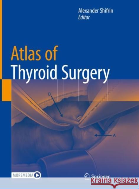 Atlas of Thyroid Surgery Alexander Shifrin   9783030936723 Springer Nature Switzerland AG - książka