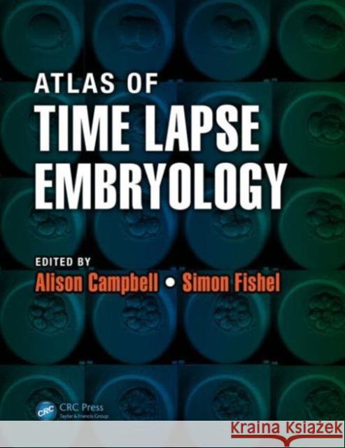 Atlas of Time Lapse Embryology Simon Fishel Alison Campbell 9781482214468 CRC Press - książka