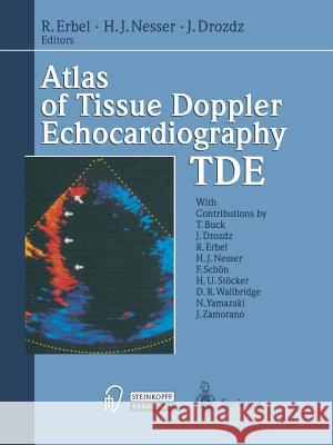 Atlas of Tissue Doppler Echocardiography -- Tde Erbel, R. 9783642470691 Steinkopff-Verlag Darmstadt - książka