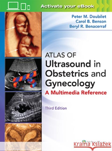 Atlas of Ultrasound in Obstetrics and Gynecology Peter M. Doubilet Carol B. Benson Beryl R. Benacerraf 9781496356055 LWW - książka