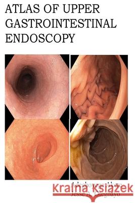 Atlas of Upper Gastrointestinal Endoscopy Jesse Abiodun Otegbayo Dennis a. Ndububa Adegboyega Akere 9781974166503 Createspace Independent Publishing Platform - książka