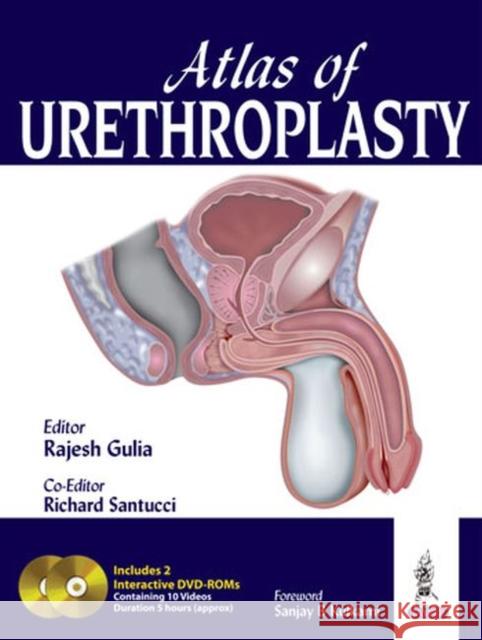 Atlas of Urethroplasty Rajesh Gulia 9789350906514 Jp Medical Ltd - książka