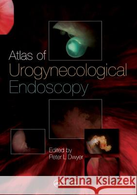 Atlas of Urogynecological Endoscopy Peter L. Dwyer Dwyer L. Dwyer 9781841845401 Informa Healthcare - książka