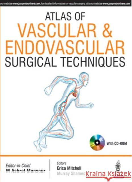 Atlas of Vascular & Endovascular Surgical Techniques M. Ashraf Mansour 9789351525271 Jaypee Brothers, Medical Publishers Pvt. Ltd. - książka